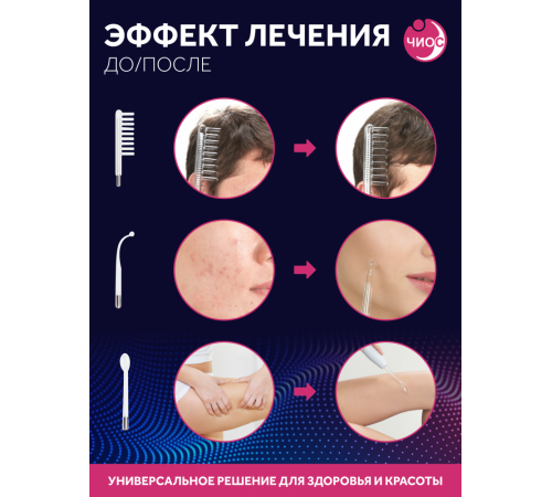 Дарсонваль массажер "Звезда" СН-101 Классик